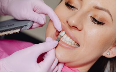 Dental Veneers: A Complete Guide to Costs, Types, and What to Expect