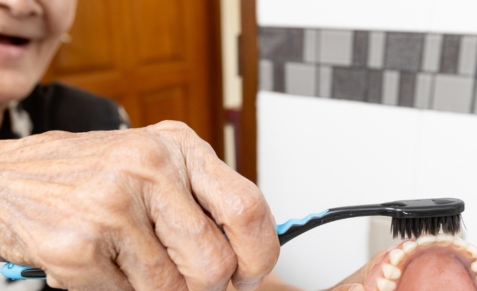 dentures-affordable-dentists-auckland-1