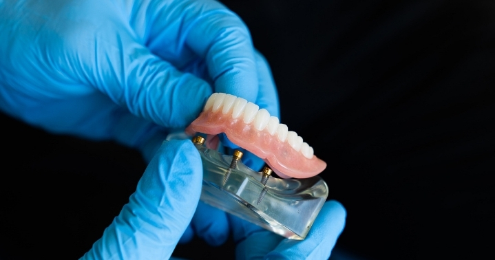 dentures-repairs