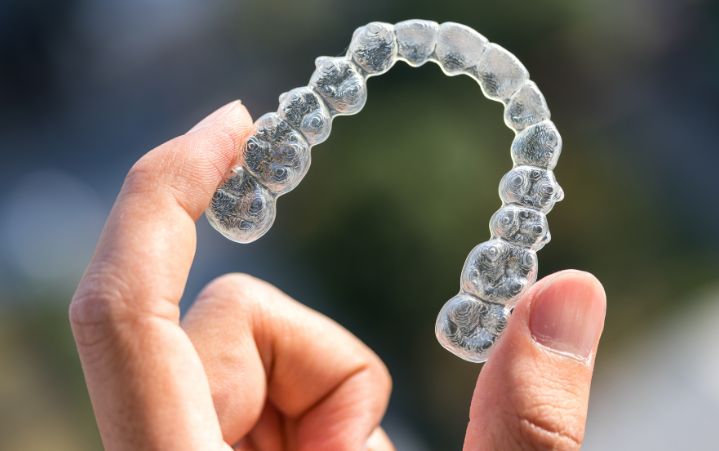 invisalign-affordable-dentists-auckland-nz-1