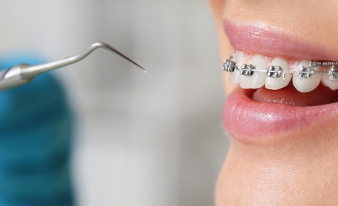 orthodontics-affordable-dentists-auckland-1