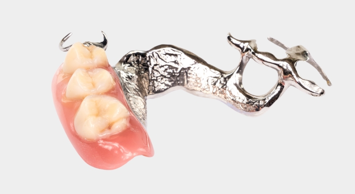 removable-partial-dentures-affordable-dentists-auckland