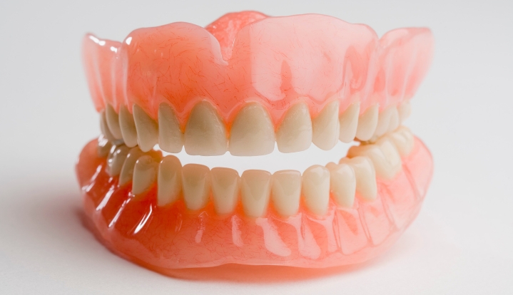 retained-overdenture-affordable-dentists-auckland