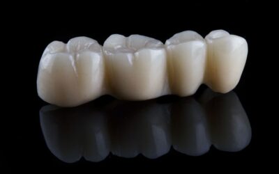 Same-Day Dental Crowns and Bridges at Affordable Dentists