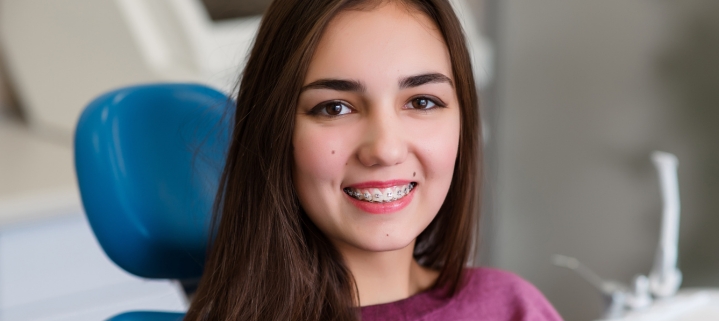 teenager-braces-affordable-dentists-auckland
