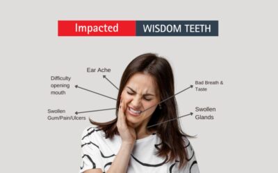 Wisdom Tooth Pain: What You Need to Know