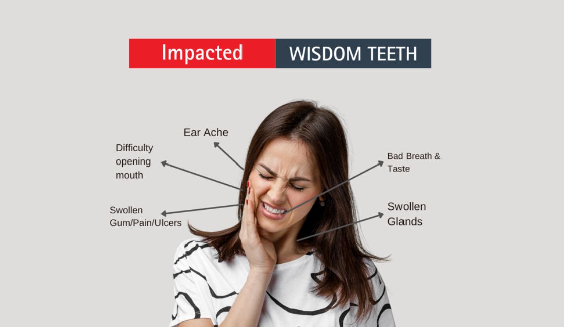 wisdom tooth pain symptoms cause prevention